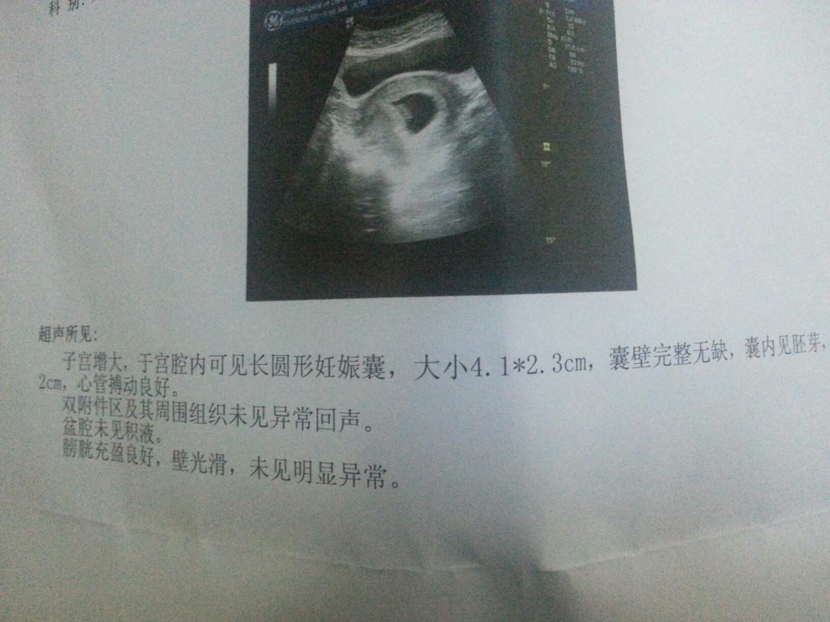 胎心胎芽都有了,怎么看子宫前位还是后位啊?只看楼主