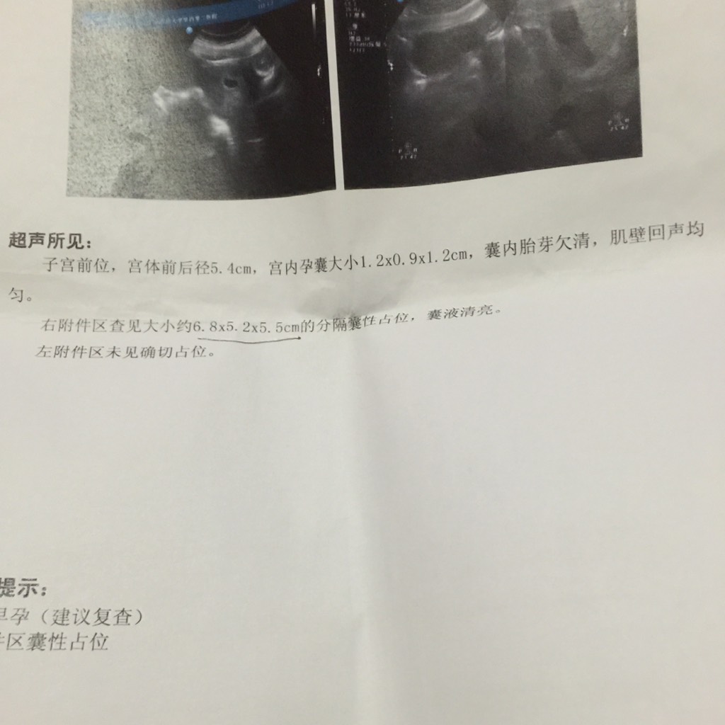 还有我有甲减,怀这个宝宝前两个月自然流产了一个.
