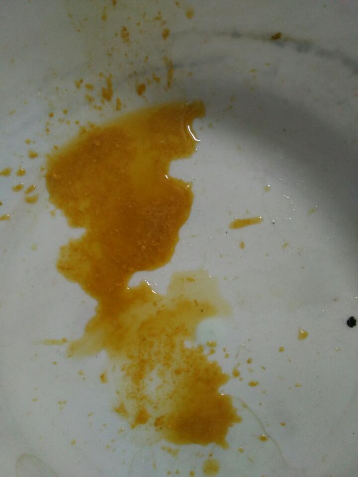 两个月的宝宝吃母乳,大便特别稀而且还有奶瓣正常么