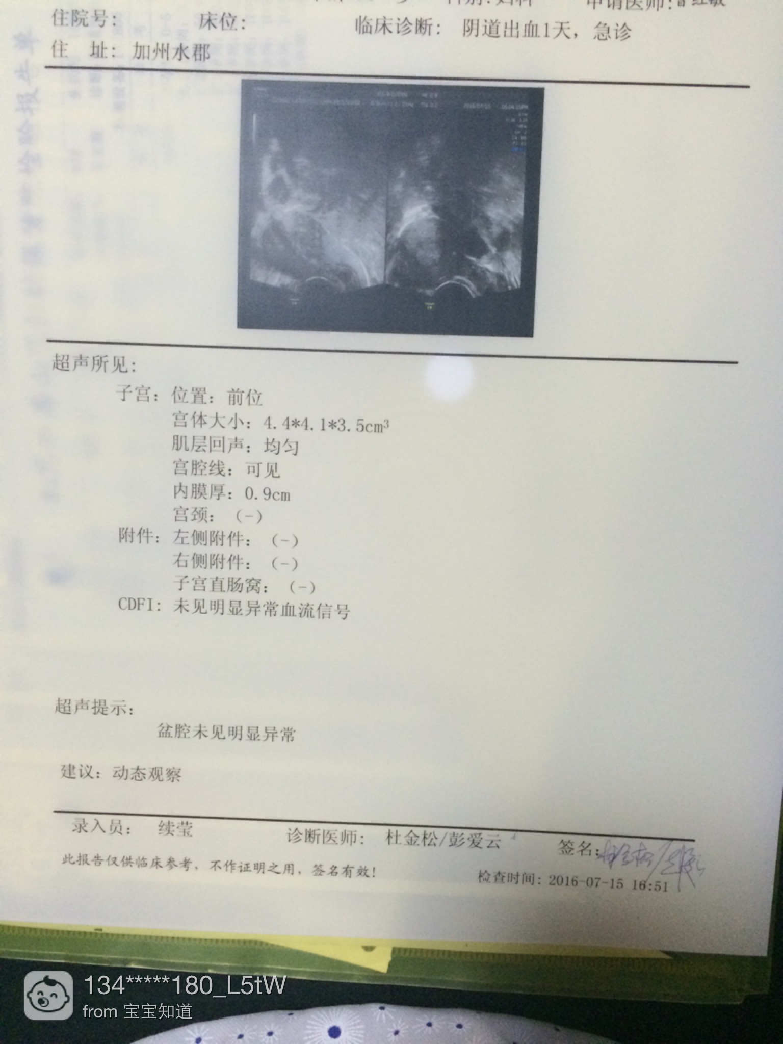 怀疑是宫外孕