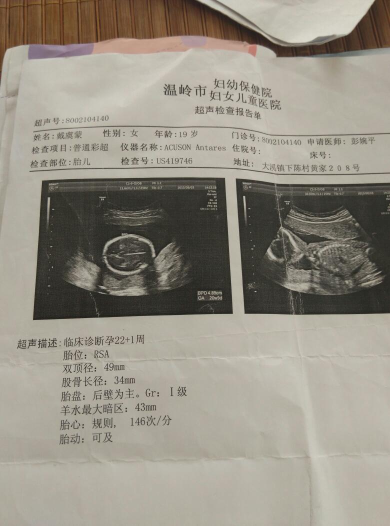 我怀孕7周 4有谁会看胎囊知道男宝宝女宝宝哦,谢咯嘻嘻只看楼主