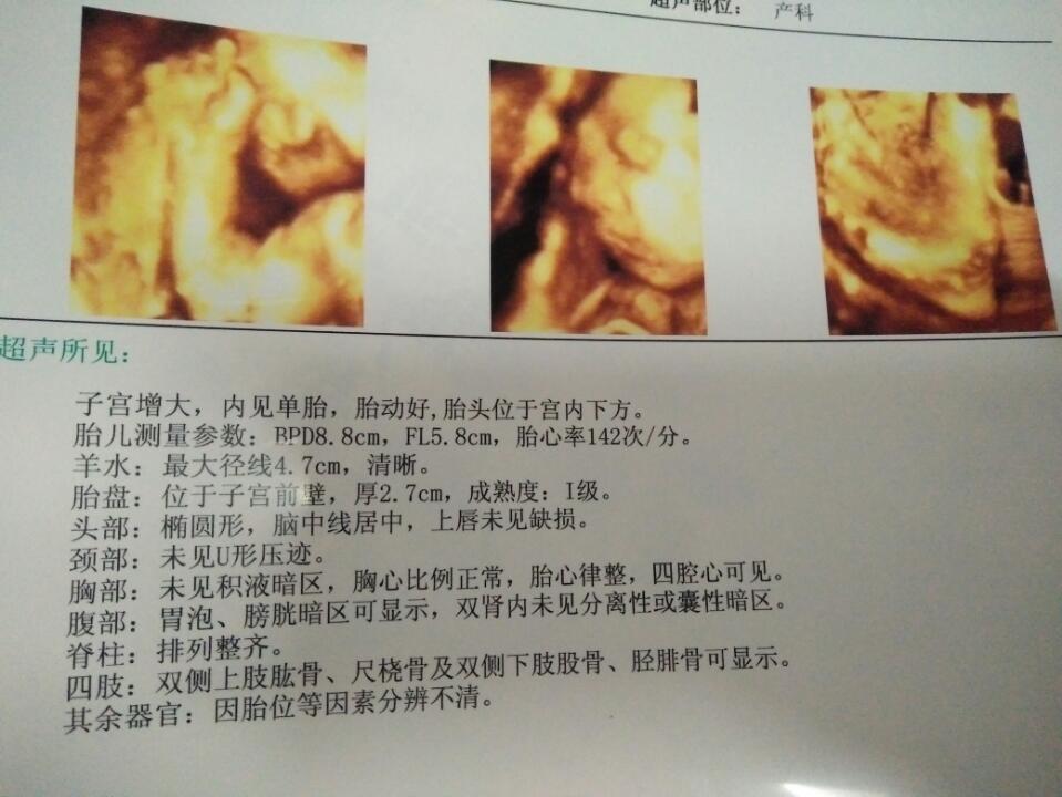 孕32周 胎儿测量参数 bpd8.8cm fl5.8cm 胎儿是多大多
