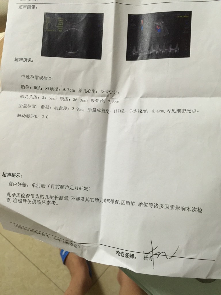 孕40周b超结果如下