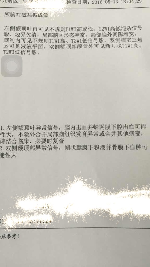 求解读这个磁共振的报告