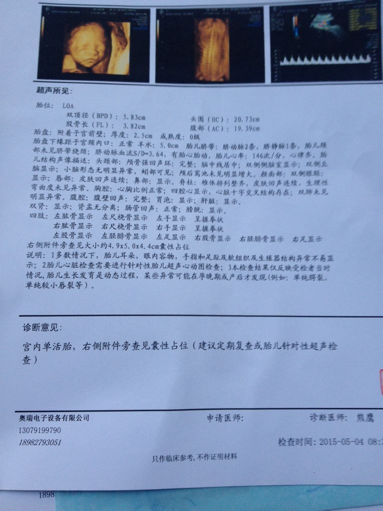 帮帮我,b超图片上传不了,网速慢!