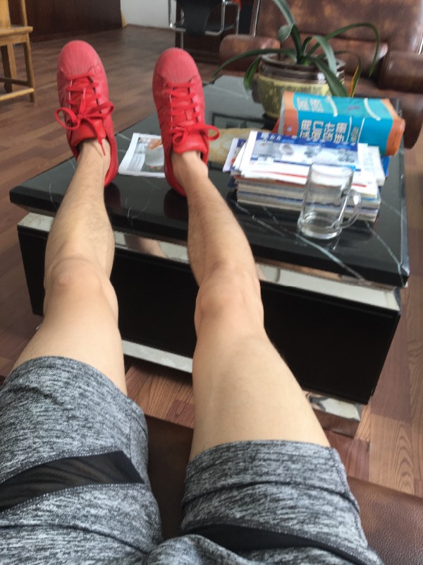 我这个是o型腿吗,我弹跳非常好 可是两腿站直时 中间碰不到一起.而且