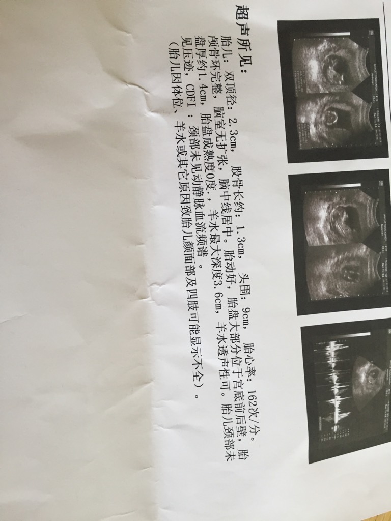 胎盘大部分位于宫底前后壁
