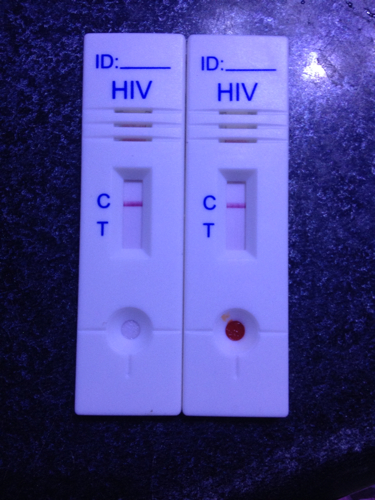 hiv试纸包埋线显色图片