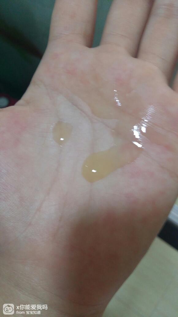 孕30 3乳房流液体,透明状的,淡黄色,用手接了好几滴,不知道是什么