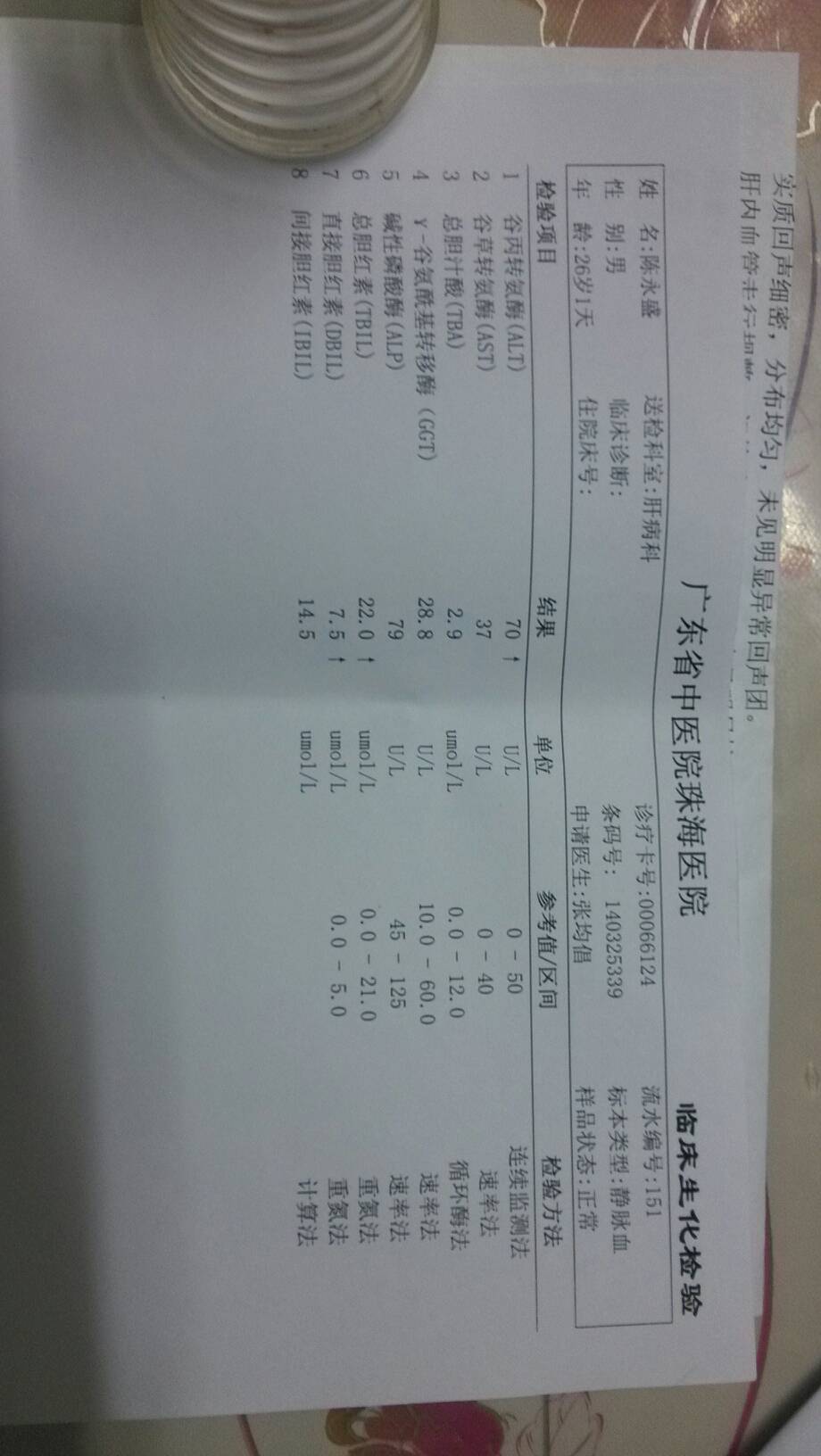就这两张有些不正常,两对半结果还没出来