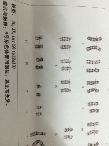 染色体9号体臂间倒位这样情况影响怀孕吗?有什么不好影响?