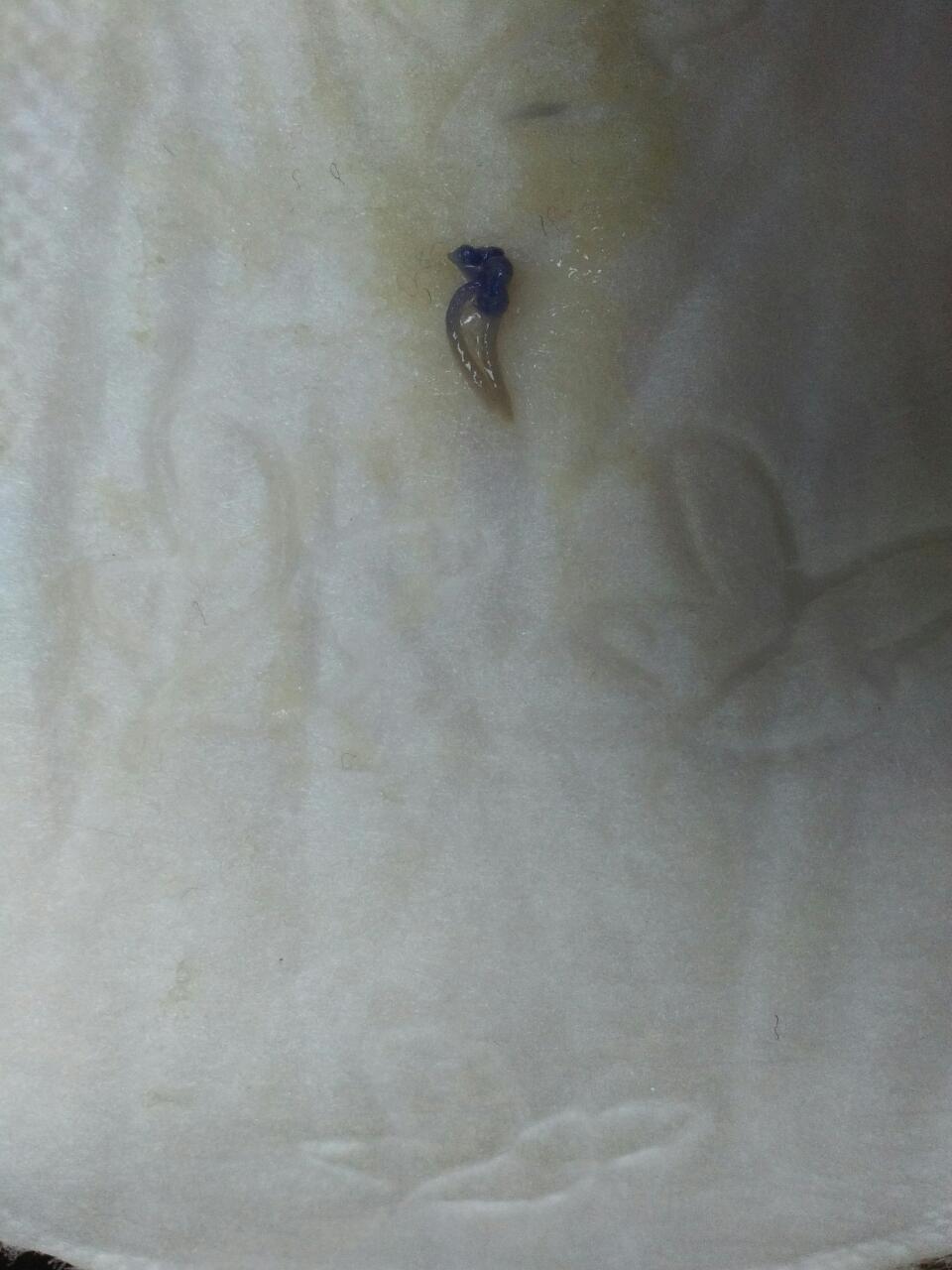顺产,月子35天了,今早上上卫生间就看见了这个,是什么是线头吗?