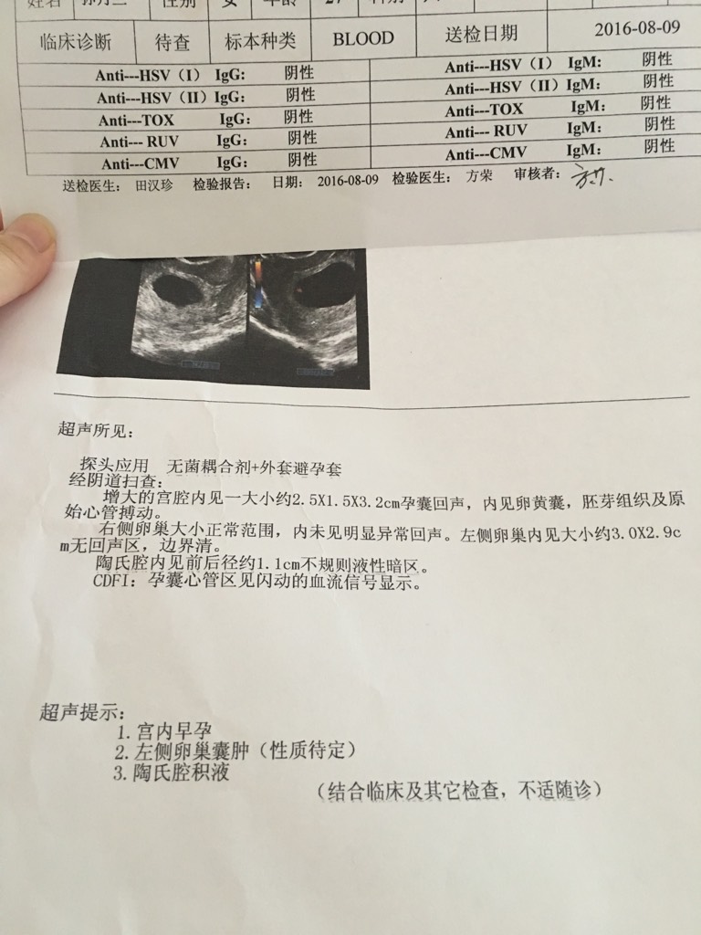 怀孕五十天做的b超