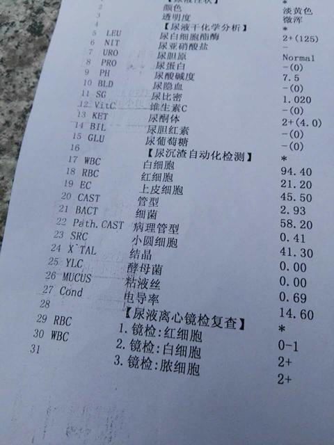 6岁小女孩尿检白细胞计数94.4,上皮细胞45.5,细菌58.