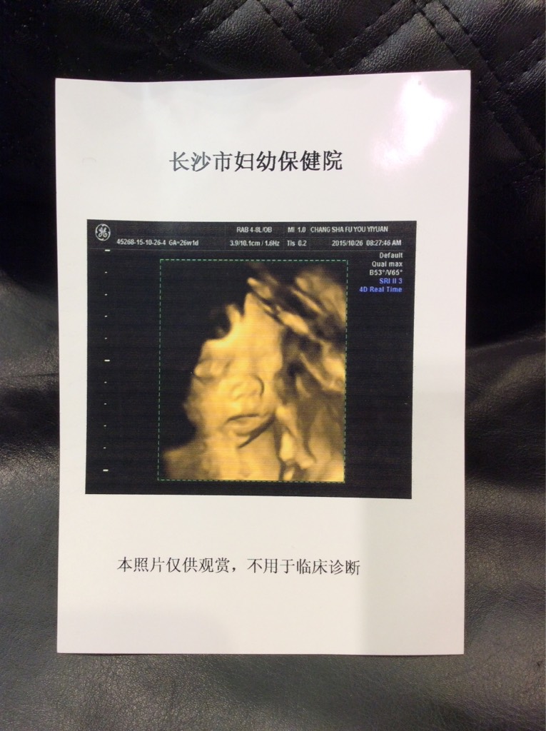 26周的男宝宝肚型,宝妈们,你们是这样的么?