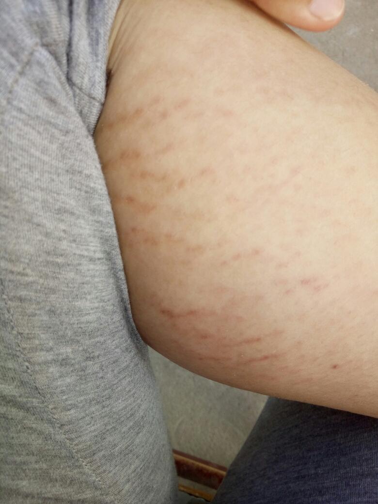已经胖了快40斤,特别是屁股和大腿,小腿上,就连小腿肚胖的也起妊辰纹