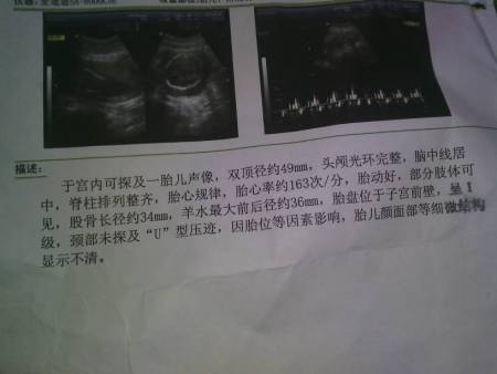 2014-03-18 郑金炽 主任医师 怀孕20周胎儿彩超图 2014-03-25 吴成秀