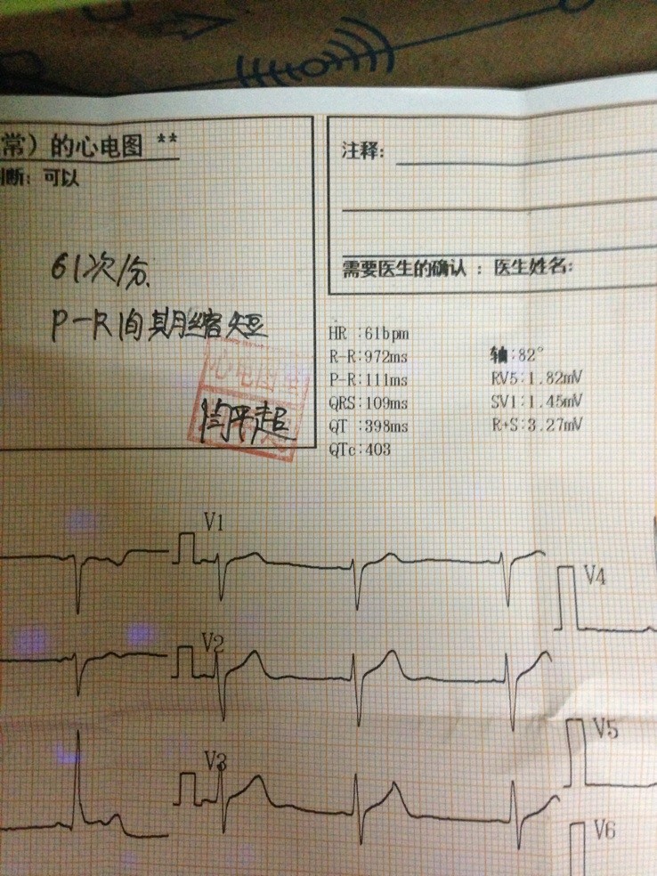 我平常有时心慌心跳加快,今天做了心电图,谁知道我这算正常吗?