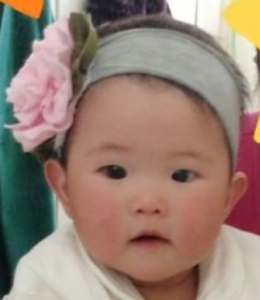 我的小孩是斗鸡眼么?